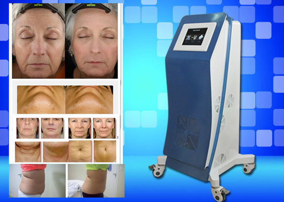 Το παγώνοντας βάρος εξοπλισμού Lipo λέιζερ Cryo χάνει τη μηχανή εγχώριας ομορφιάς